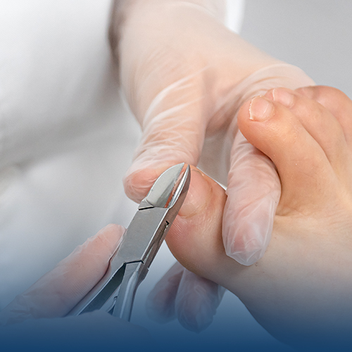 Podiatry Instruments